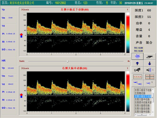 經(jīng)顱多普勒雙通道，單深度界面