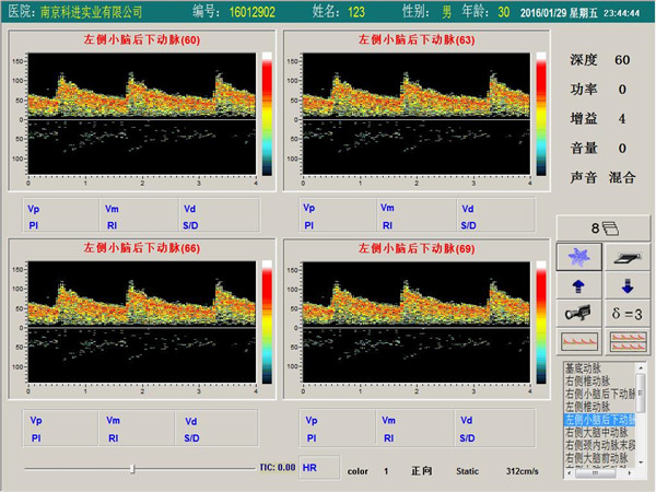 經(jīng)顱多普勒單通道，四深度界面