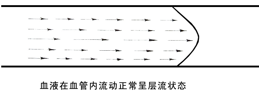 血液在血管內(nèi)流動(dòng)正常呈層流狀態(tài).jpg