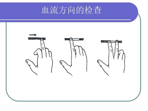 超聲經(jīng)顱多普勒對(duì)顱內(nèi)血流方向的檢查