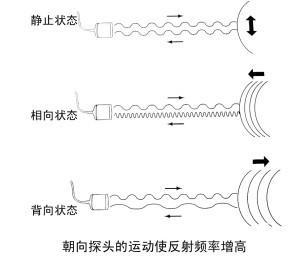 TCD廠家教你什么是超聲多普勒效應(yīng)