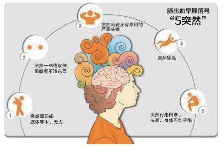 心腦血管病別等發(fā)作才篩查，經(jīng)顱多普勒TCD超聲檢測心腦血管