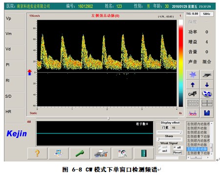 經(jīng)顱多普勒軟件CW模式下單窗口檢測(cè)界面