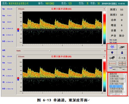 經(jīng)顱多普勒軟件單通道雙深度檢測(cè)界面